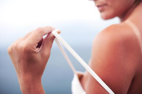 Les coups de soleil causent de graves lésions cutanées pouvant rendre malade votre proche.